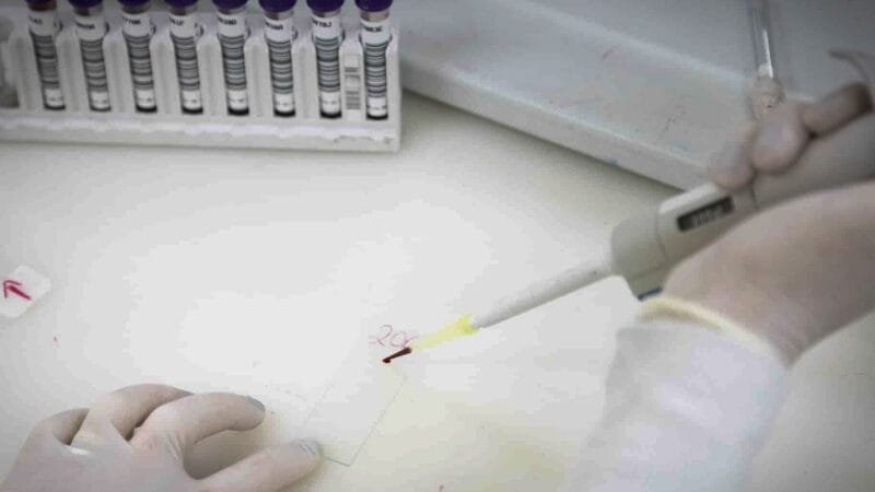 Homem em São Paulo Testa Positivo para Meningite Após Suspeita de Ebola