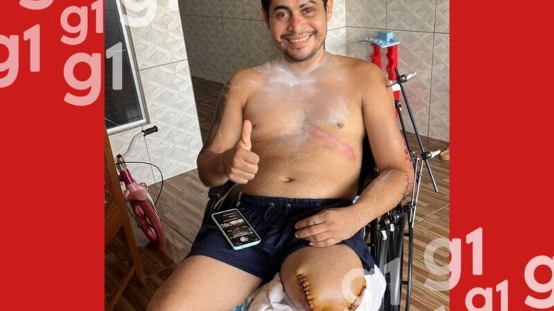 Motociclista Enfrenta Desafios Financeiros Após Acidente Grave no Acre