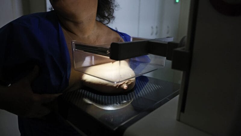 ANS Propõe Ampliação na Cobertura da Mamografia Digital para Todos os Gêneros e Idades