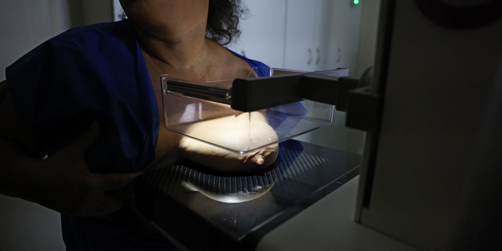 ANS Propõe Ampliação na Cobertura da Mamografia Digital para Todos os Gêneros e Idades