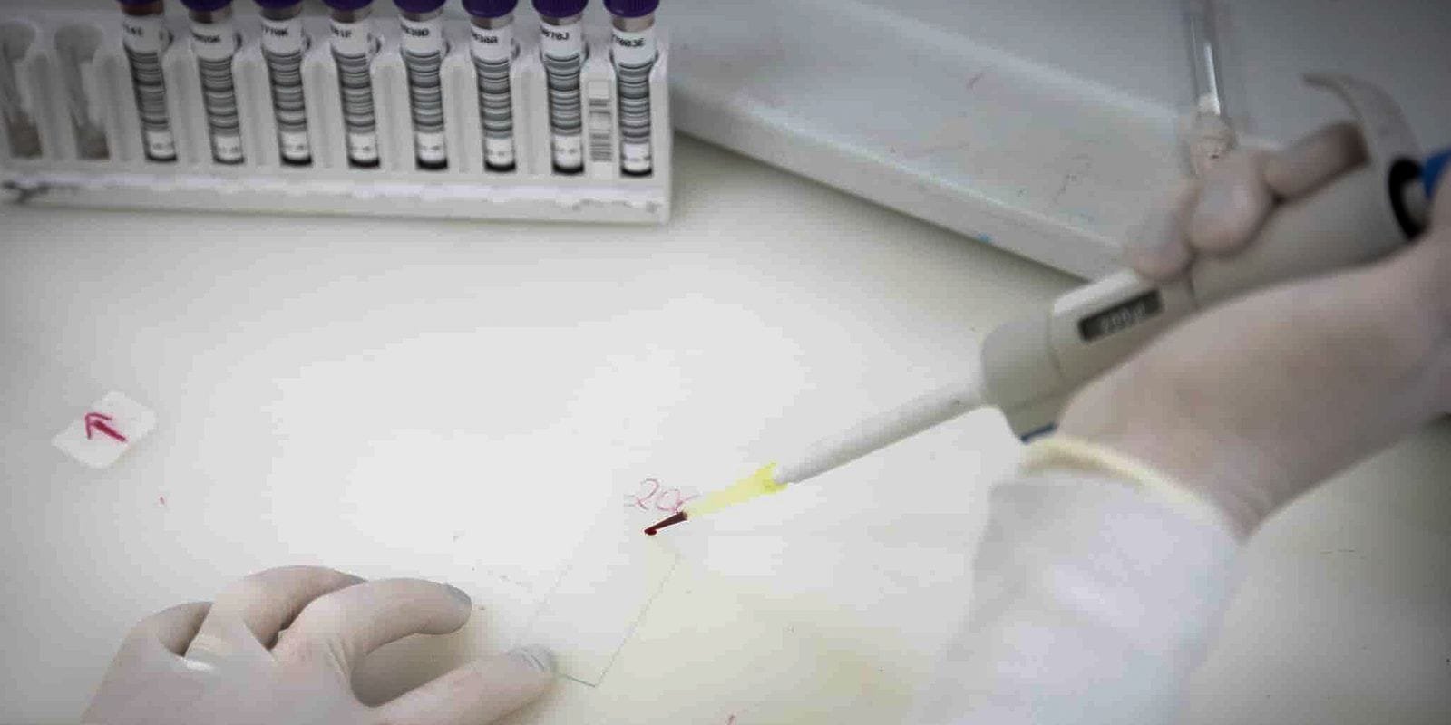 Exames Confirmam Ausência de Ebola em Imigrante Congolês em São Paulo