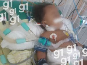 Família de Bebê no Acre Enfrenta Desafios em Busca de Diagnóstico para Convulsões