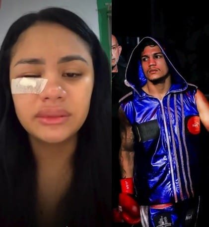 Investigação de Atleta de Boxe por Agressão à Ex-Esposa Choca Belém
