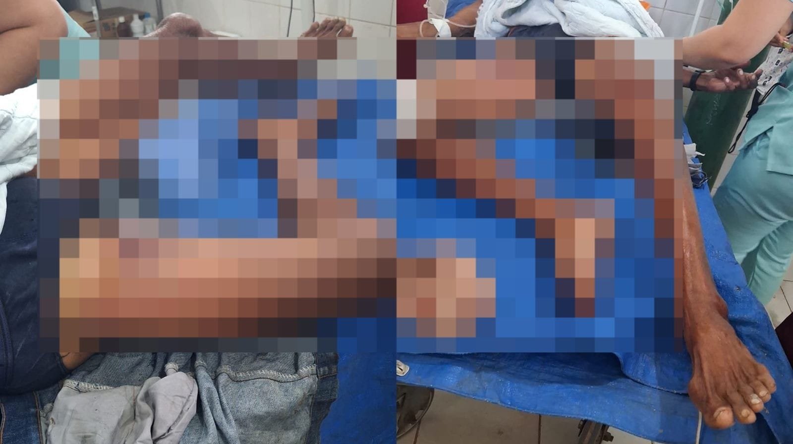 Idoso é Resgatado Após Assalto Violento em Óbidos, Pará