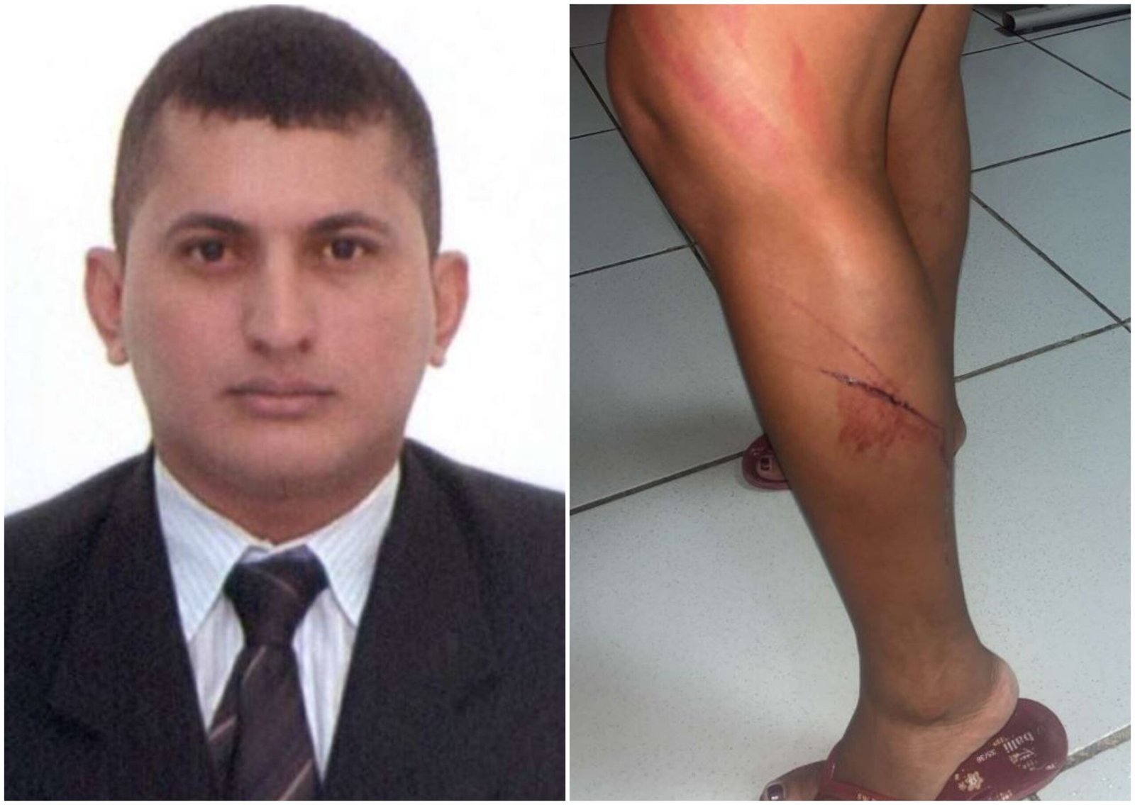 Liberdade Provisória de Advogado Acusado de Agressão a Ex-Companheira é Condicionada a Fiança
