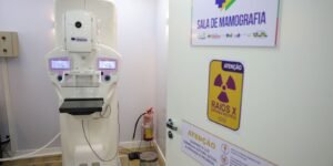 Crescimento das Cirurgias Plásticas de Mama no SUS: Um Panorama de 2016 a 2025