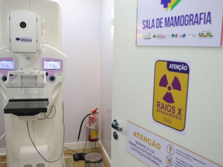 Crescimento das Cirurgias Plásticas de Mama no SUS: Um Panorama de 2016 a 2025