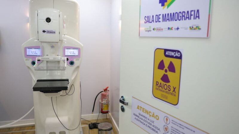 Crescimento das Cirurgias Plásticas de Mama no SUS: Um Panorama de 2016 a 2025