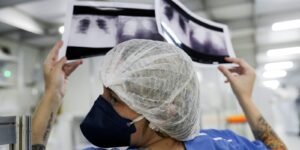 Câncer de Pulmão: Desafios do Diagnóstico Precoce no Brasil