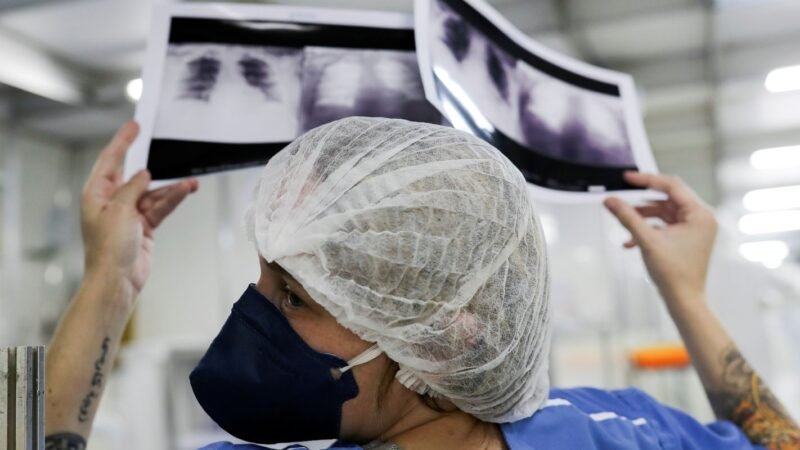 Câncer de Pulmão: Desafios do Diagnóstico Precoce no Brasil