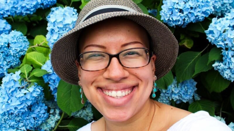 Superando a Alopecia Areata: Histórias de Esperança e Autoestima