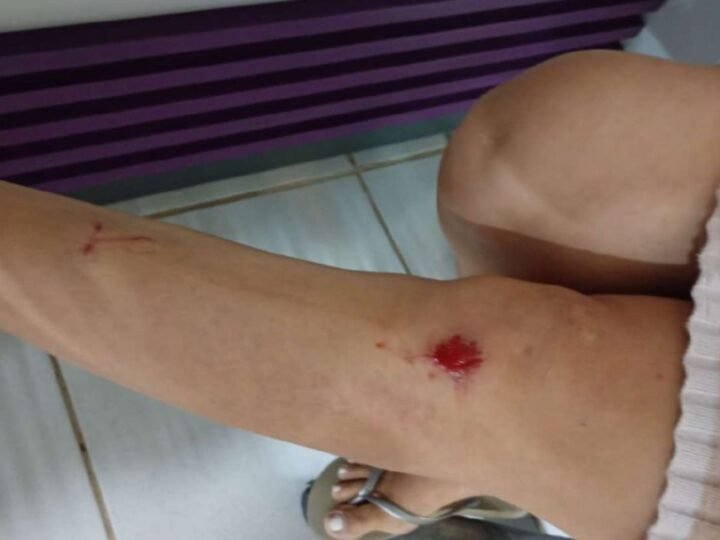 Tenente-Coronel do Exército é Acusado de Agressão em Boa Vista