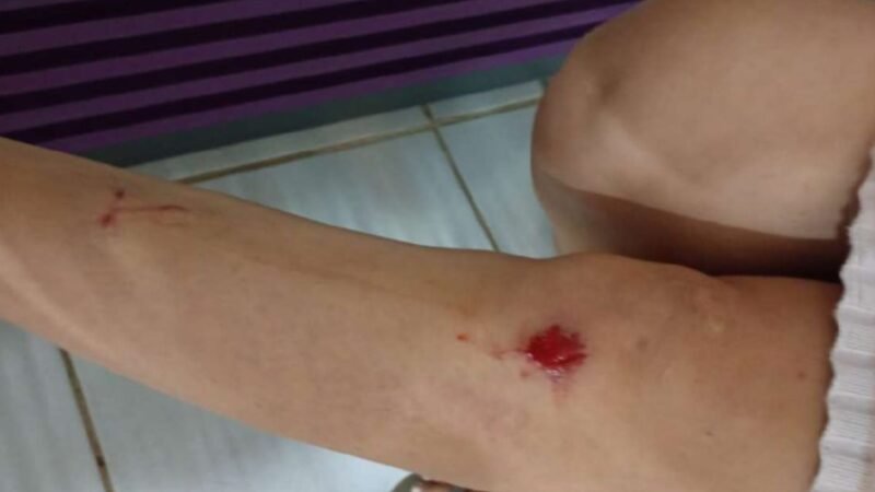 Tenente-Coronel do Exército é Acusado de Agressão em Boa Vista