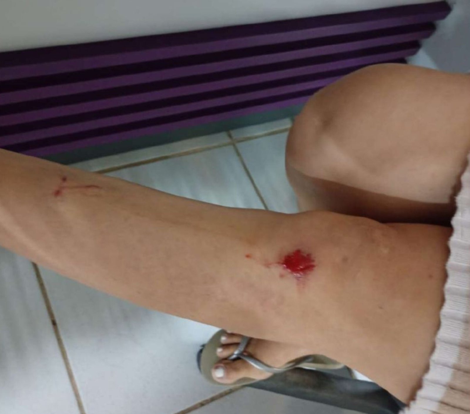 Tenente-Coronel do Exército é Acusado de Agressão em Boa Vista