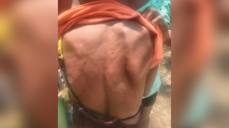 Idosa de 77 Anos Sofre Agressão pelo Filho em Belterra, Pará