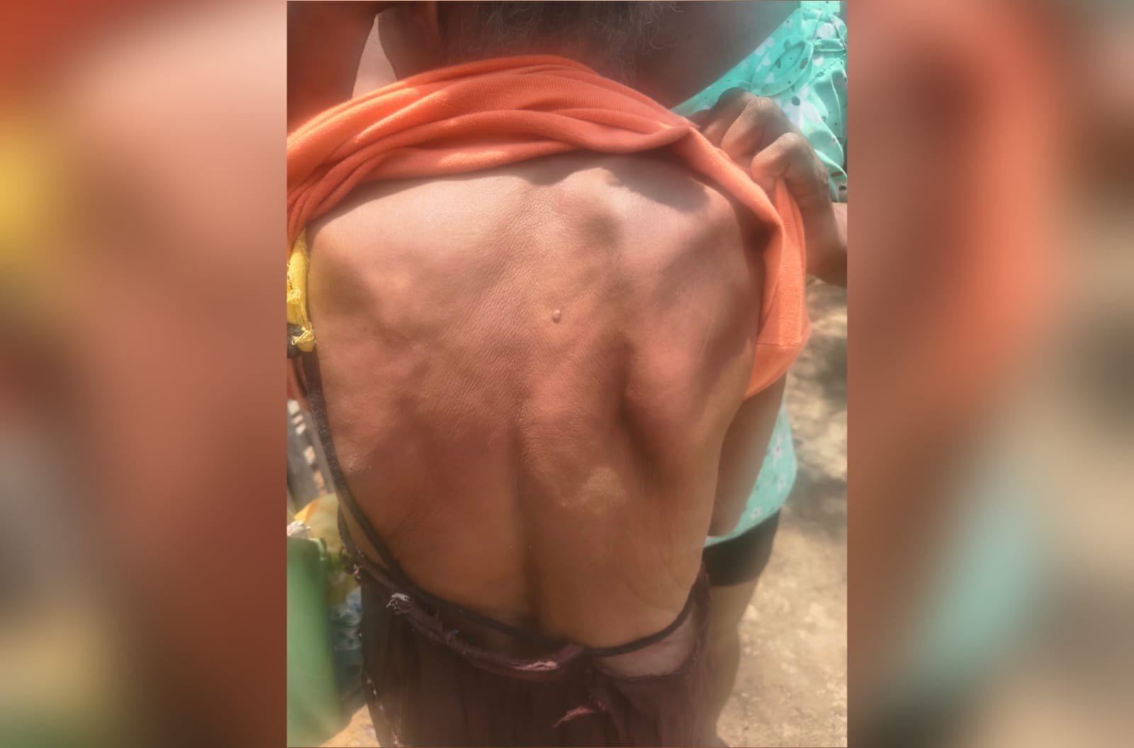 Idosa de 77 Anos Sofre Agressão pelo Filho em Belterra, Pará
